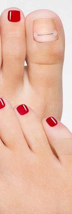 Педикюр , титановая нить