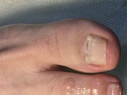 Устанoвление коррекционной системы 