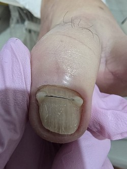 חוט טיטניום. Титановая нить.