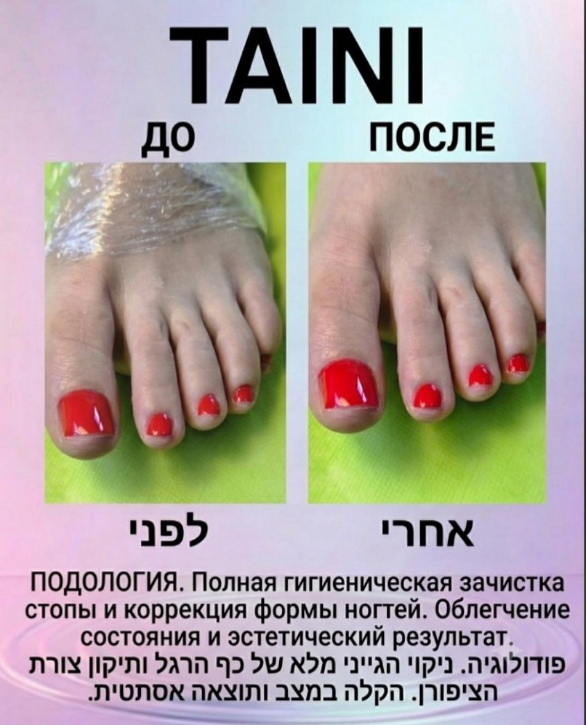 Гигиеническая зачистка стопы и коррекция формы ногтей в TAINI. ​Слева (До / לפני): Подготовка стопы к обработке — нанесено специальное средство под пленку для бережного размягчения огрубевшей кожи. ​Справа (После / אחרי): Результат комплексного ухода — аккуратная форма ногтей, ровное покрытие, чистая кутикула и гладкая, здоровая кожа. ​ניקוי היגייני של כף הרגל ותיקון צורת הציפורניים ב-TAINI. ​משמאל (לפני): הכנת כף הרגל לטיפול — חומר מיוחד מתחת לניילון לריכוך עדין של עור קשה. ​מימין (אחרי): תוצאה של טיפול מקיף — צורת ציפורניים מדויקת, מראה נקי, עור מסביב מטופח וכף רגל חלקה ובריאה.